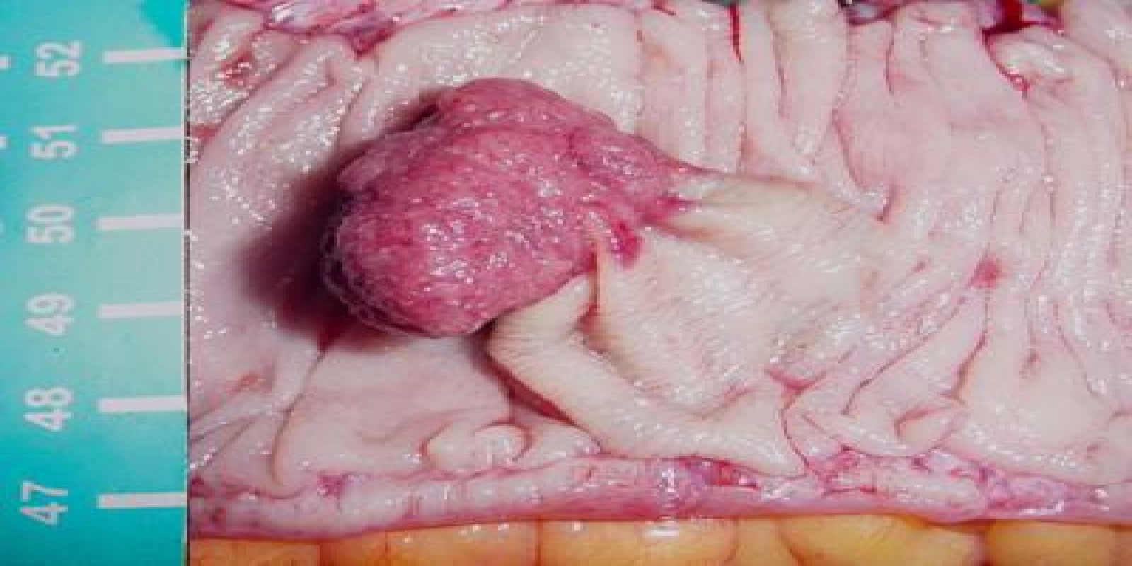 Best gear for preist twink Anus uterine polyps